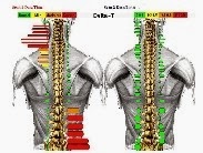 Photo of Altman Wellness Center - Chiropractor Englewood, NJ in Englewood City, New Jersey, United States - 10 Picture of Point of interest, Establishment, Health, Doctor