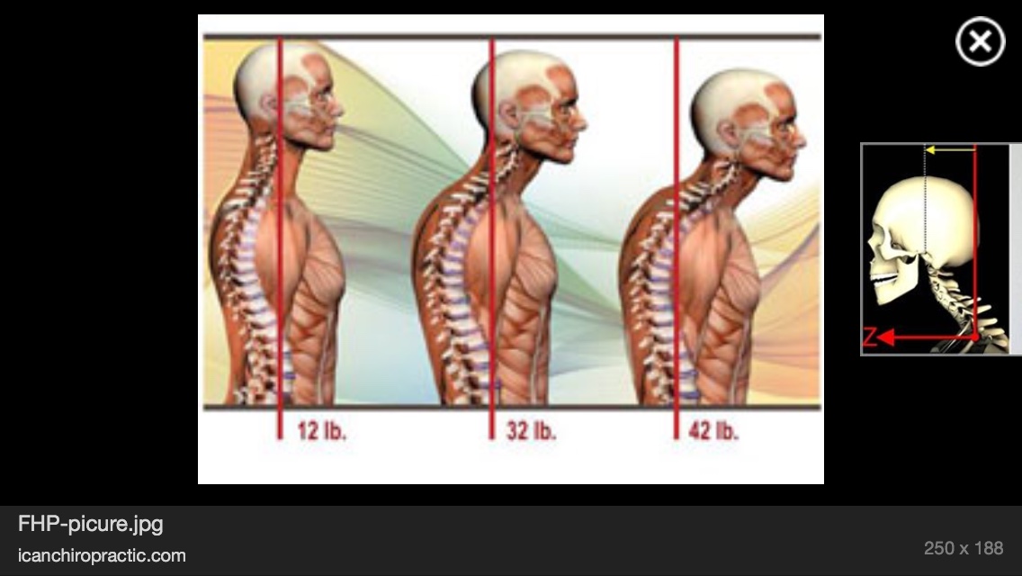 Photo of Synergy Wellness Chiropractic & Physical Therapy PLLC in New York City, New York, United States - 6 Picture of Point of interest, Establishment, Health