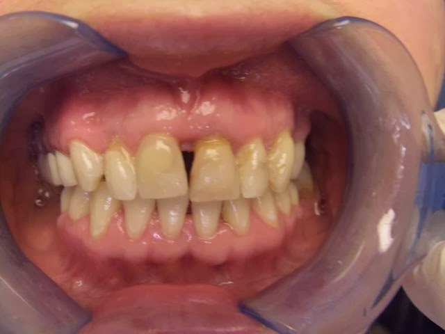 Photo of Now Dental: Rothstein & Chopp DDS, LLP in Queens City, New York, United States - 1 Picture of Point of interest, Establishment, Health, Dentist