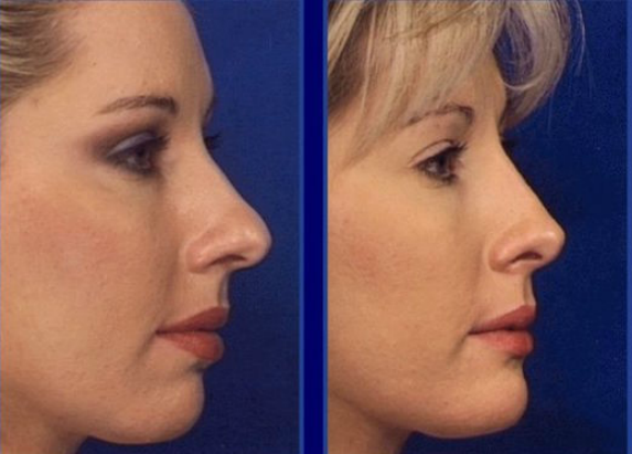 Photo of Liquid Facelift NYC in New York City, New York, United States - 2 Picture of Point of interest, Establishment, Health, Doctor