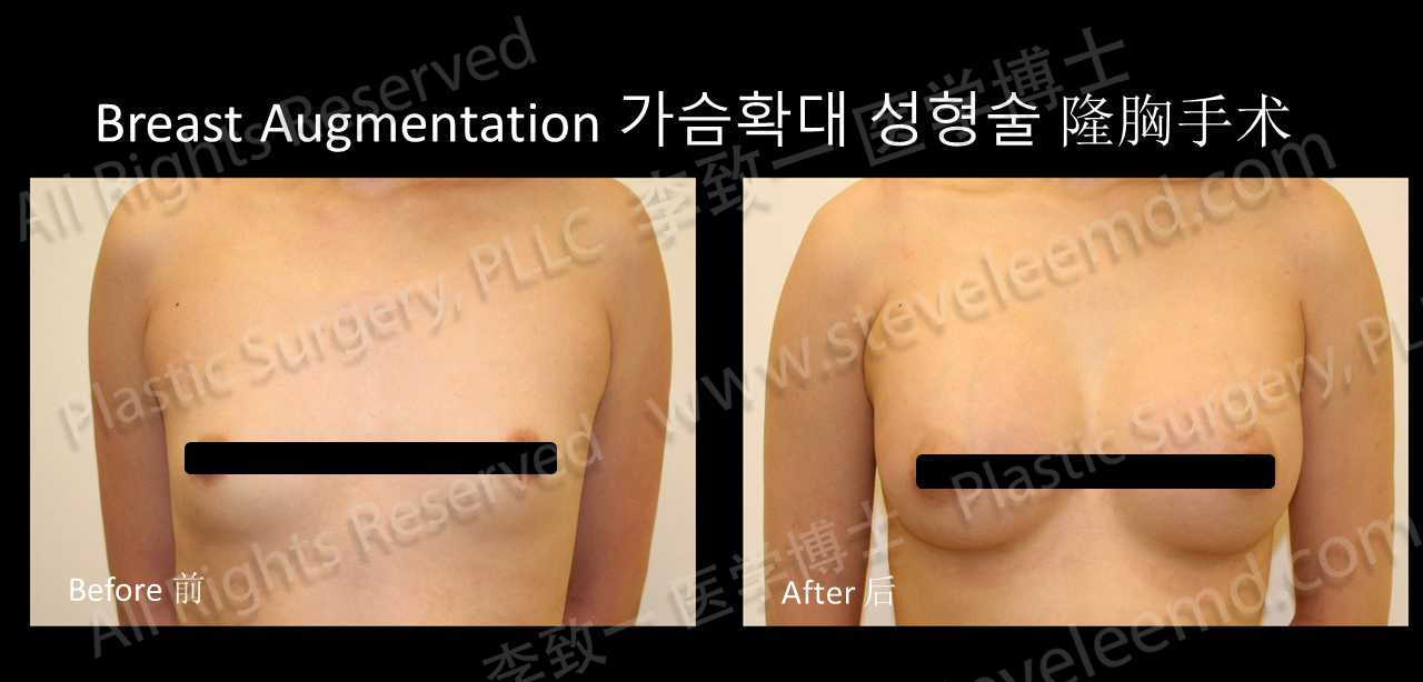 Photo of Steve Lee, M.D., Plastic Surgery, PLLC 李致一 醫學博士 in Queens City, New York, United States - 4 Picture of Point of interest, Establishment, Health, Doctor