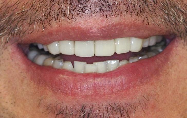 Photo of Cosmetic Dentistry: Dr. Valentin and Alexander Lezhansky DDS in Brooklyn City, New York, United States - 4 Picture of Point of interest, Establishment, Health, Dentist