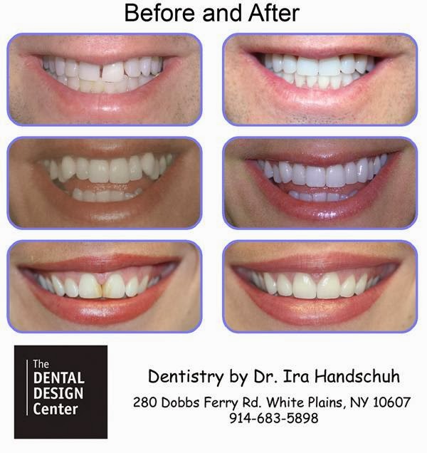 Photo of The Dental Design Center in New York City in New York City, New York, United States - 1 Picture of Point of interest, Establishment, Health, Dentist