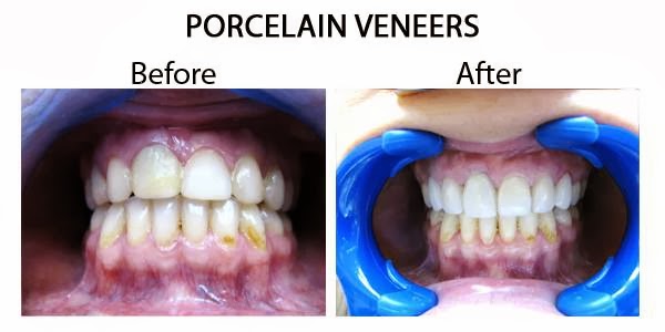 Photo of Island Smile Dental in Long Beach City, New York, United States - 1 Picture of Point of interest, Establishment, Health, Dentist