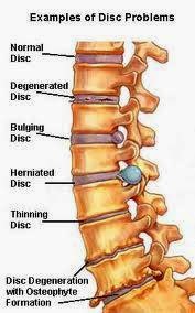 Photo of Advanced Pain Management in Springfield Township City, New Jersey, United States - 2 Picture of Point of interest, Establishment, Health, Doctor