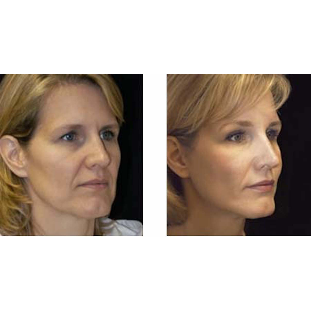 Photo of Best Cosmetic Dermatologist in New York City, New York, United States - 2 Picture of Point of interest, Establishment, Health, Doctor