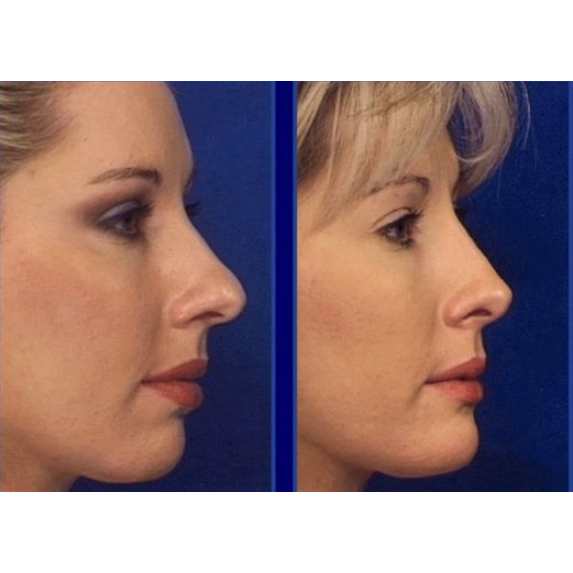 Photo of Park Avenue Rhinoplasty in New York City, New York, United States - 5 Picture of Point of interest, Establishment, Health, Doctor