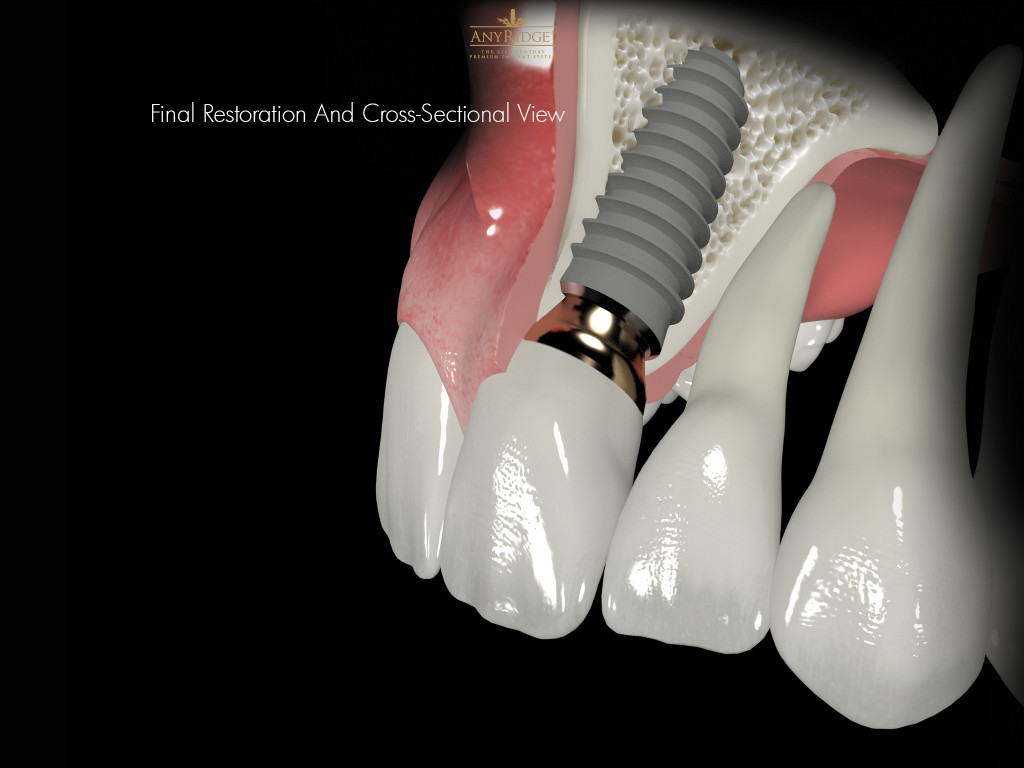 Photo of Charlie Chen DDS / 诚和植牙牙科中心 / 3D Dental Implant Center in Kings County City, New York, United States - 10 Picture of Point of interest, Establishment, Health, Doctor, Dentist