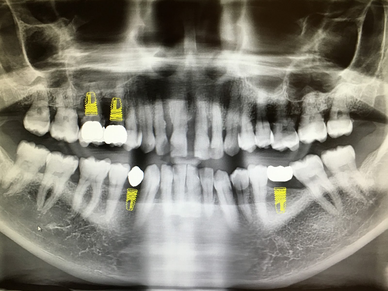 Photo of Yonkers Avenue Dental in Yonkers City, New York, United States - 6 Picture of Point of interest, Establishment, Health, Doctor, Dentist