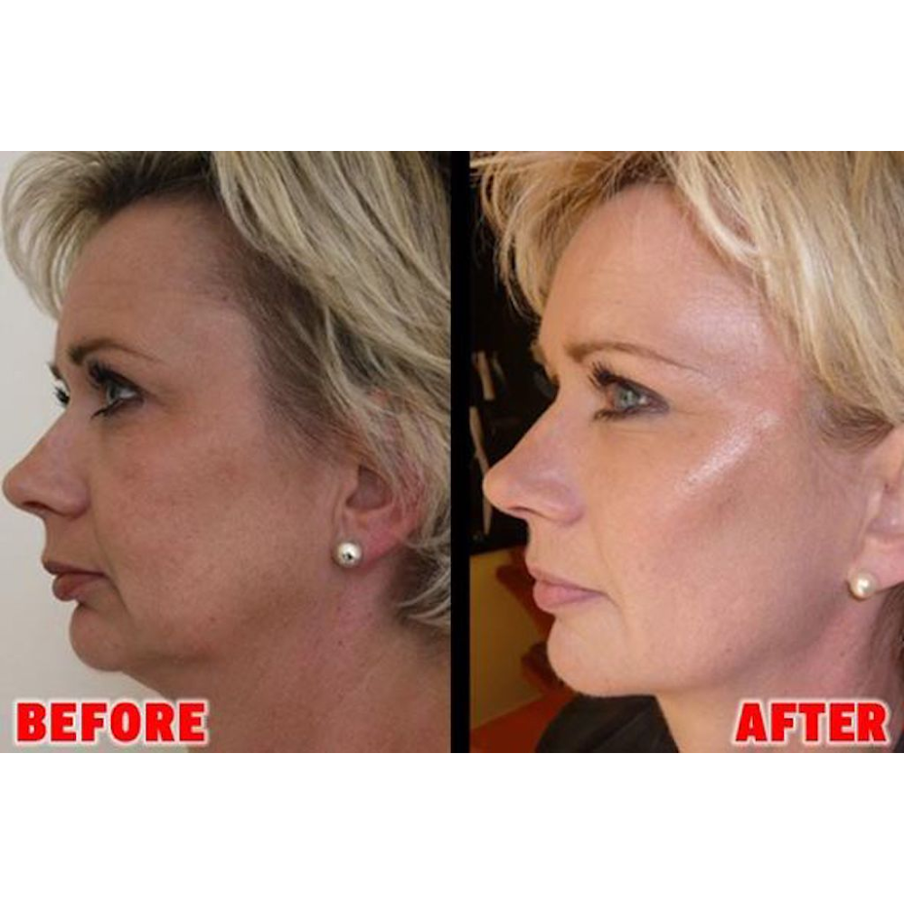 Photo of Juvederm in New York City, New York, United States - 7 Picture of Point of interest, Establishment, Health, Doctor