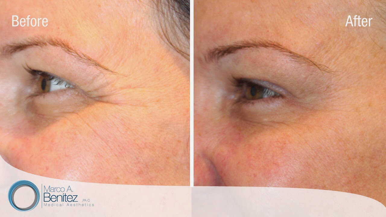 Photo of Premier Aesthetics- Astoria Botox Dermal Filler Plasma PRP in Queens City, New York, United States - 8 Picture of Point of interest, Establishment, Health, Spa