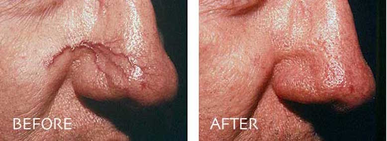 Photo of Juvederm in New York City, New York, United States - 6 Picture of Point of interest, Establishment, Health, Doctor