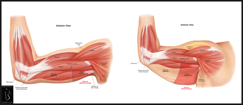 Photo of Park Avenue Smart Lipo in New York City, New York, United States - 4 Picture of Point of interest, Establishment, Health, Doctor