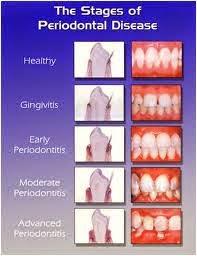 Photo of Dr. Alexander Milman, DDS in Jersey City, New Jersey, United States - 5 Picture of Point of interest, Establishment, Health, Dentist