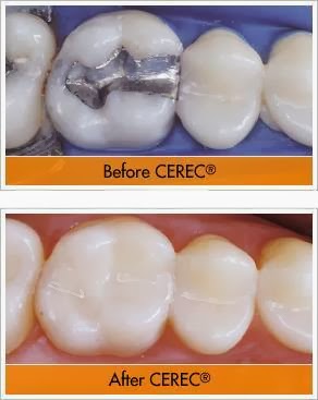 Photo of Forest Hills Dental P.C. Gregory Mark, DDS in Queens City, New York, United States - 7 Picture of Point of interest, Establishment, Health, Dentist