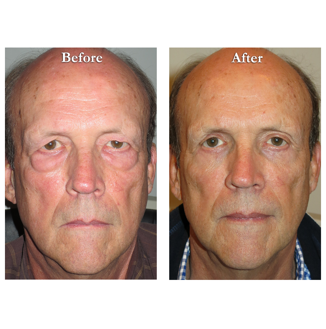 Photo of Dr. Dan Landmann - Cosmetic & Reconstructive Eyelid Surgery in Maywood City, New Jersey, United States - 4 Picture of Point of interest, Establishment, Health, Doctor