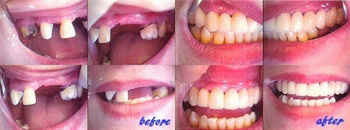 Photo of Universal Dental Implant Center in Fort Lee City, New Jersey, United States - 4 Picture of Point of interest, Establishment, Health, Dentist
