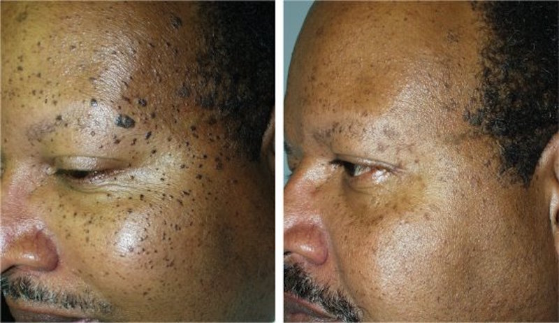 Photo of Black Dermatology NYC in New York City, New York, United States - 6 Picture of Point of interest, Establishment, Health, Doctor