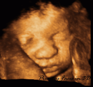 Photo of PRECIOUS FACES IN 3D ULTRASOUND - MOBILE in Glen Rock City, New Jersey, United States - 1 Picture of Point of interest, Establishment, Store, Health, Clothing store, Doctor, Subpremise