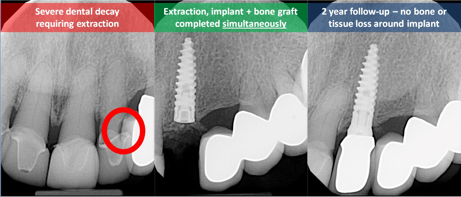 Photo of Bayside Periodontics & Dental Implants in Bayside City, New York, United States - 5 Picture of Point of interest, Establishment, Health, Dentist