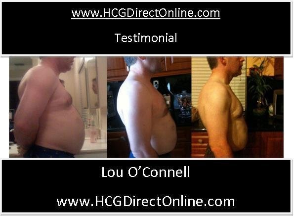 Photo of HCG Diet New York in Kings County City, New York, United States - 4 Picture of Point of interest, Establishment, Health