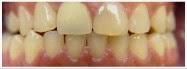 Photo of Dr. Vincent Mastronardi in West Orange City, New Jersey, United States - 7 Picture of Point of interest, Establishment, Health, Dentist