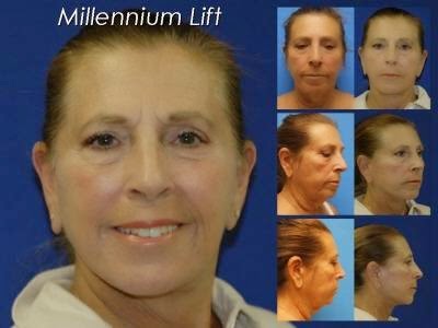 Photo of New York Face Lift Surgeon in New York City, New York, United States - 2 Picture of Point of interest, Establishment, Health, General contractor, Doctor