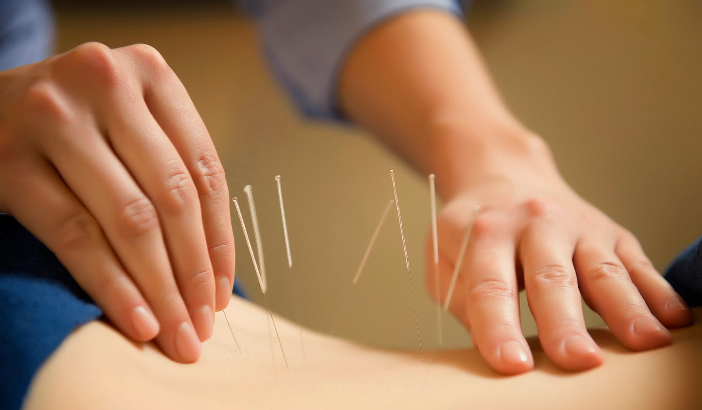 Photo of Chinese Acupuncture of Staten Island in Staten Island City, New York, United States - 1 Picture of Point of interest, Establishment, Health