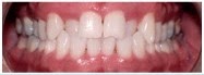 Photo of Dr. Vincent Mastronardi in West Orange City, New Jersey, United States - 2 Picture of Point of interest, Establishment, Health, Dentist