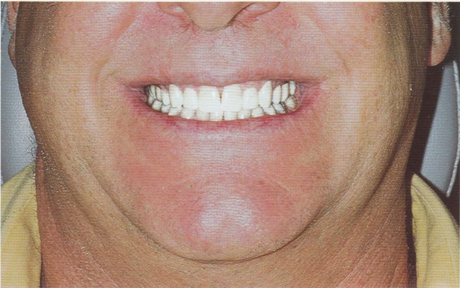 Photo of Louis P Sterling DDS in Staten Island City, New York, United States - 3 Picture of Point of interest, Establishment, Health, Doctor, Dentist