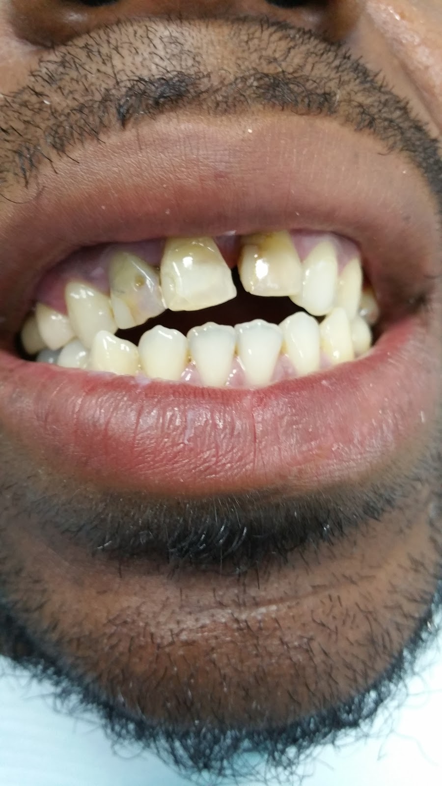 Photo of Indrajeet Singh,DDS in Astoria City, New York, United States - 1 Picture of Point of interest, Establishment, Health, Dentist