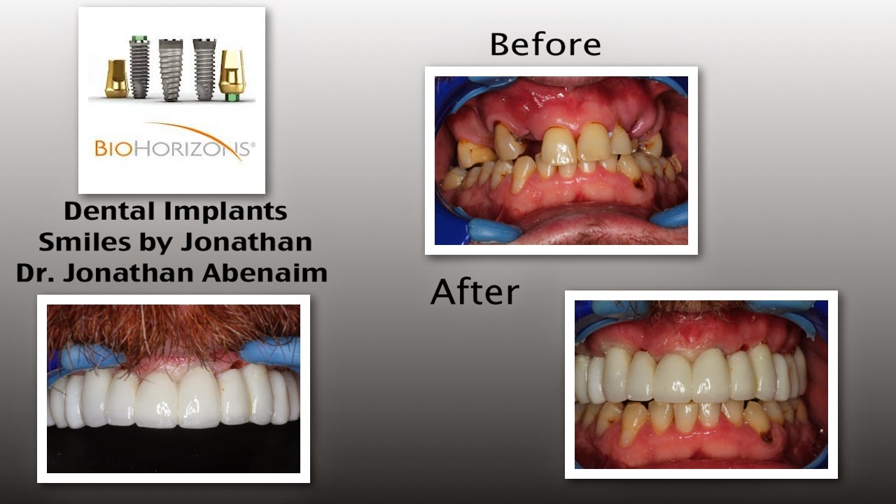 Photo of Jonathan Dental Spa Dental Implant Center Jonathan Abenaim DMD in Hawthorne City, New Jersey, United States - 8 Picture of Point of interest, Establishment, Health, Dentist