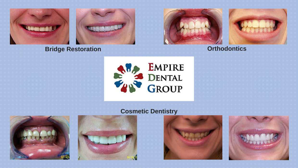 Photo of Empire Dental Group of New Jersey in Old Bridge City, New Jersey, United States - 1 Picture of Point of interest, Establishment, Health, Dentist
