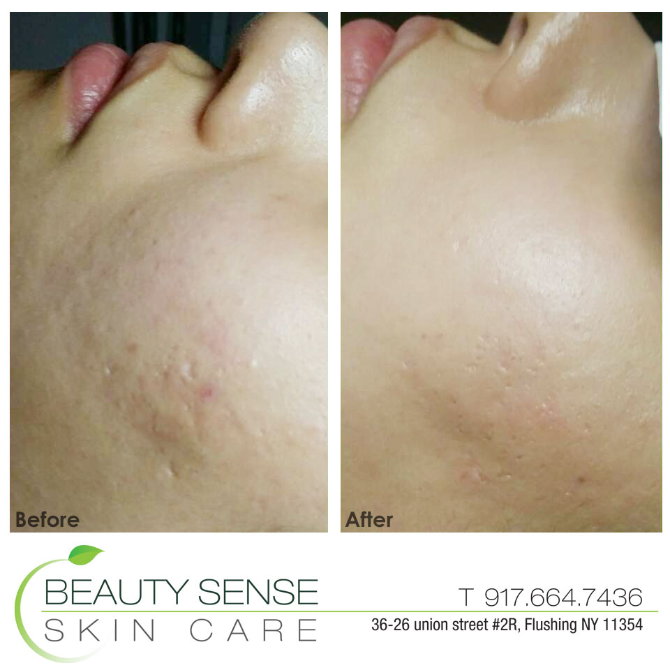 Photo of Beauty Sense Skin Care in Queens City, New York, United States - 3 Picture of Point of interest, Establishment, Health