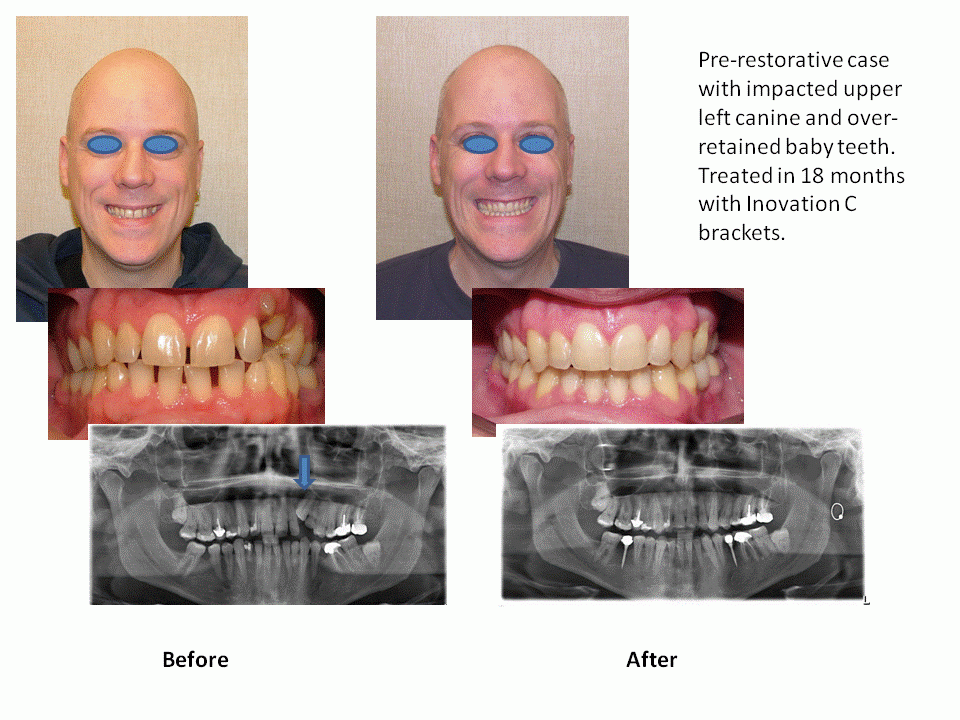 Photo of Perfect Smiles Orthodontics in New York City, New York, United States - 3 Picture of Point of interest, Establishment, Health, Dentist