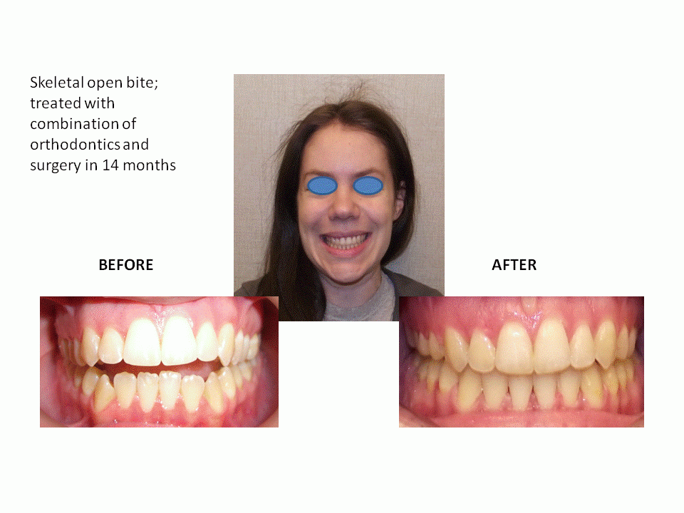 Photo of Perfect Smiles Orthodontics in New York City, New York, United States - 7 Picture of Point of interest, Establishment, Health, Dentist