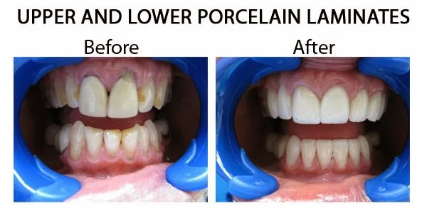 Photo of Island Smile Dental in Long Beach City, New York, United States - 9 Picture of Point of interest, Establishment, Health, Dentist