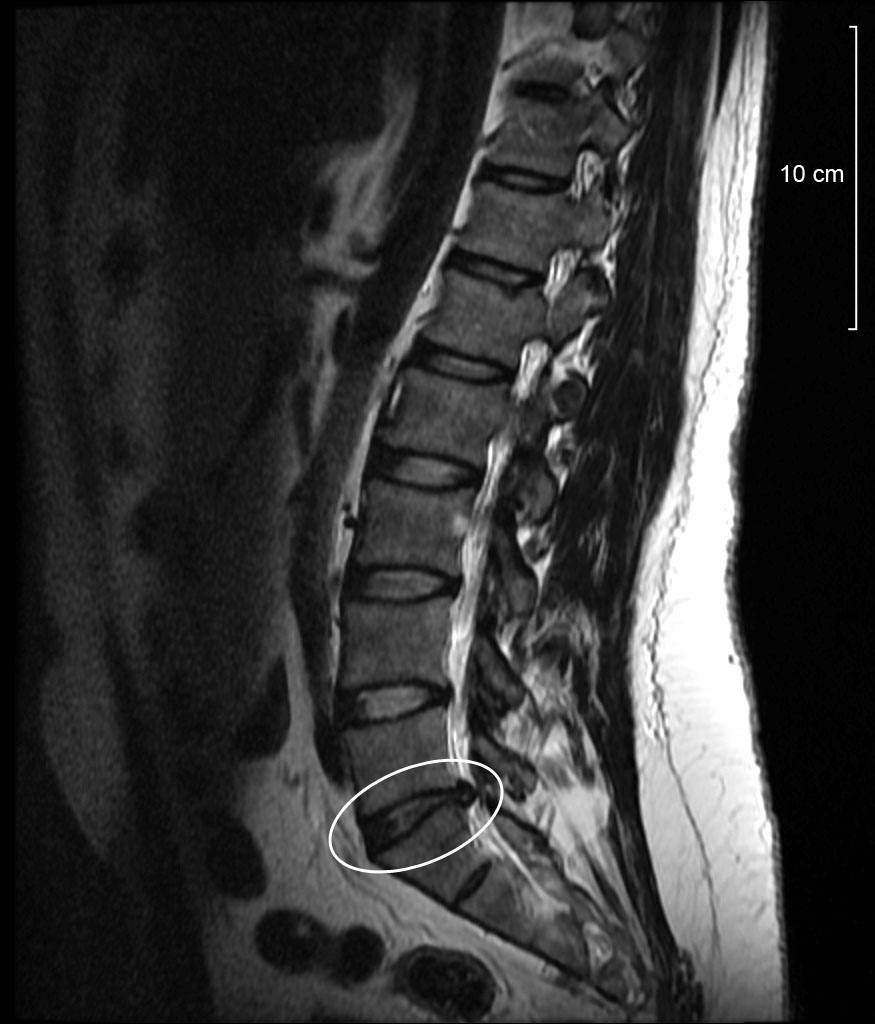 Photo of Dr. Joseph D. Salamone, DC, DAAPM, FRCCM in Fairfield City, New Jersey, United States - 4 Picture of Point of interest, Establishment, Health