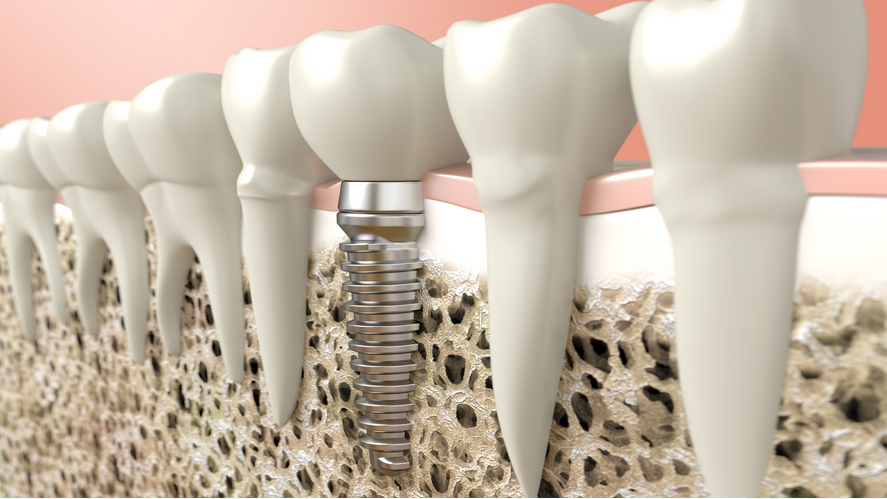 Photo of Whitestone Oral & Maxillofacial Surgery in Queens City, New York, United States - 1 Picture of Point of interest, Establishment, Health, Doctor