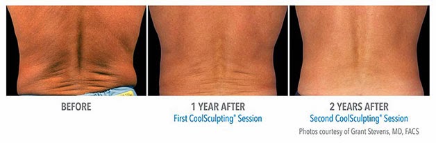 Photo of CoolSculpting Spa of Long Island in Great Neck City, New York, United States - 8 Picture of Point of interest, Establishment, Health, Hospital, Doctor