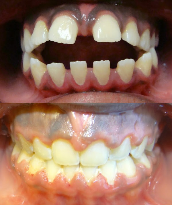 Photo of Diamond Braces in Kings County City, New York, United States - 4 Picture of Point of interest, Establishment, Health, Dentist