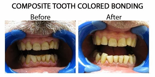 Photo of Island Smile Dental in Long Beach City, New York, United States - 2 Picture of Point of interest, Establishment, Health, Dentist