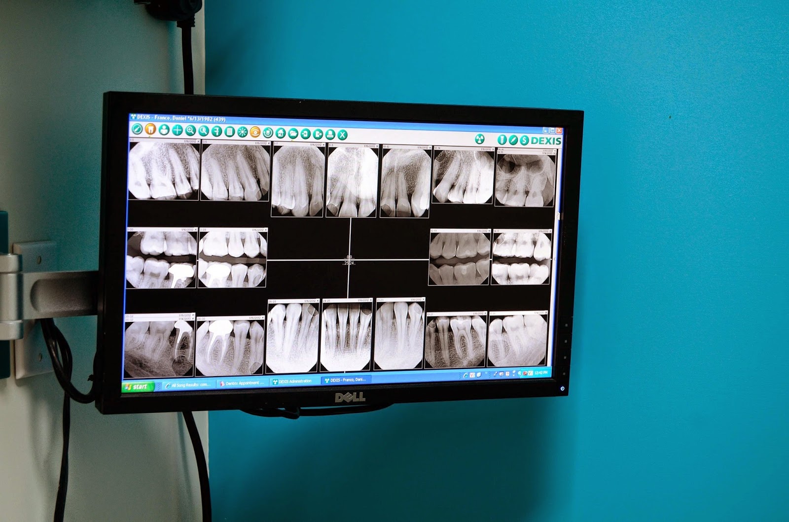 Photo of First Impression Dental in Brooklyn City, New York, United States - 8 Picture of Point of interest, Establishment, Health, Doctor, Dentist