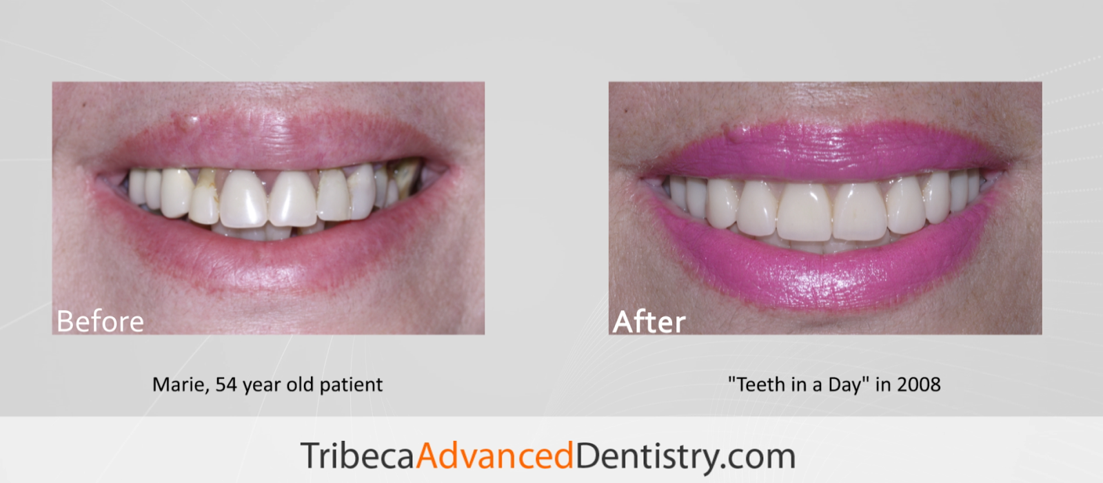 Photo of Tribeca Advanced Dentistry in New York City, New York, United States - 3 Picture of Point of interest, Establishment, Health, Dentist