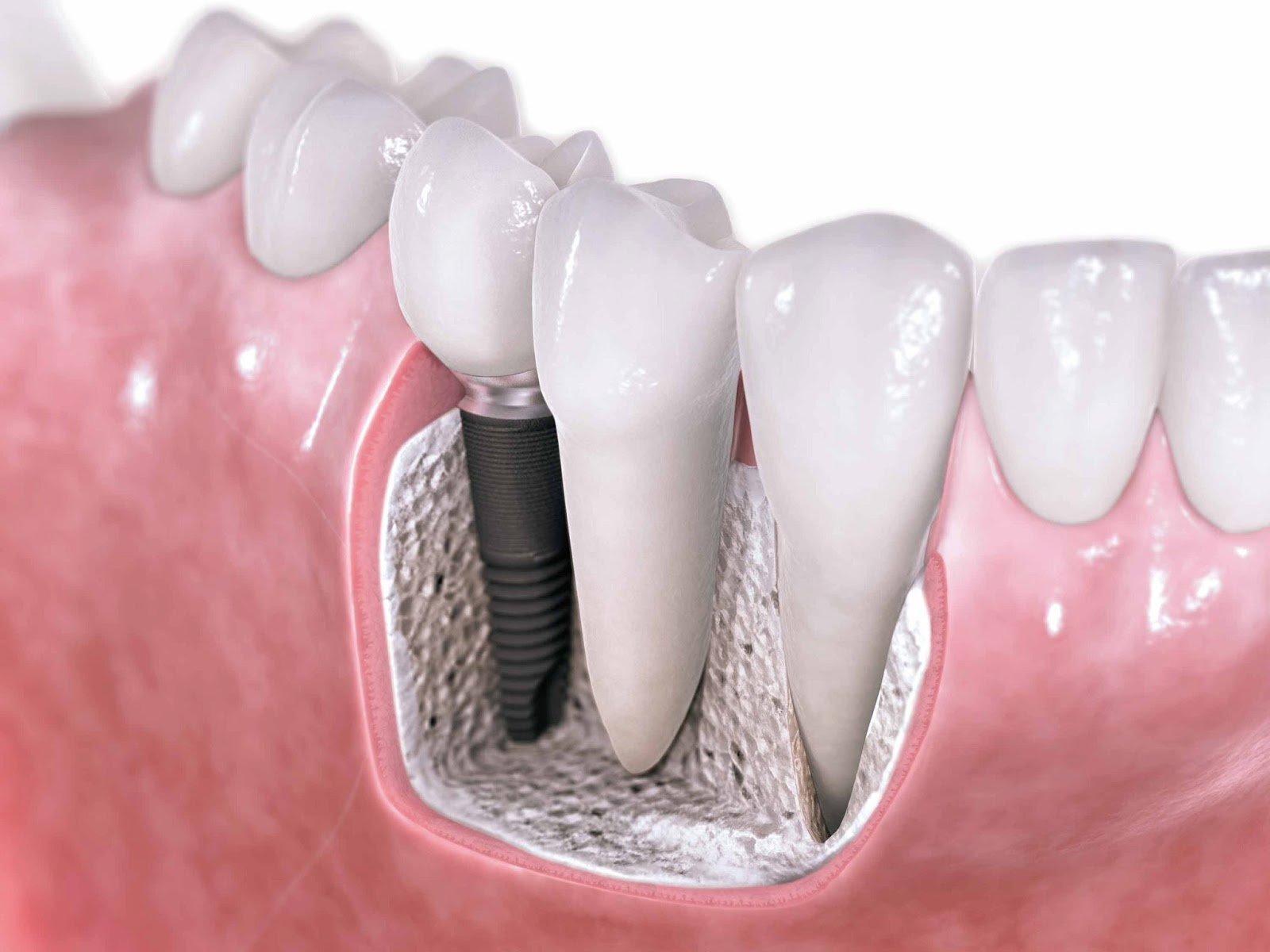 Photo of Synergy Dental Ceramics by Roberto Rossi in North New Hyde Park City, New York, United States - 3 Picture of Point of interest, Establishment, Health, Dentist