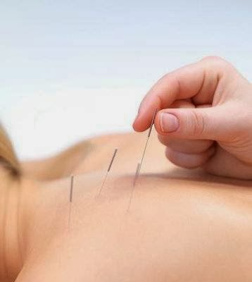 Photo of Bronx Acupuncture in Bronx City, New York, United States - 4 Picture of Point of interest, Establishment, Health