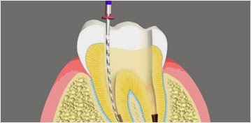 Photo of New Image Dental in Fords City, New Jersey, United States - 9 Picture of Point of interest, Establishment, Health, Doctor, Dentist