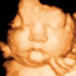 Photo of Clear Image 4D Ultrasound in Queens City, New York, United States - 1 Picture of Point of interest, Establishment, Store, Health, Clothing store, Doctor