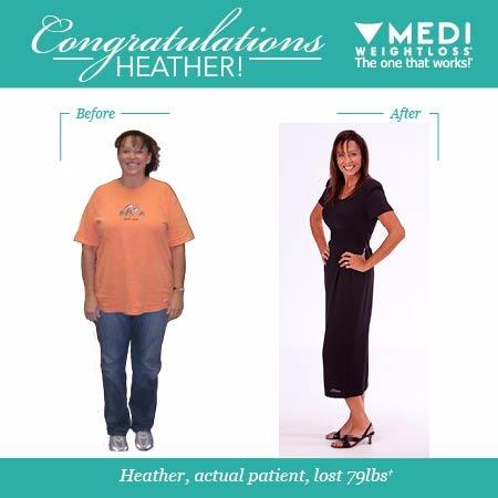 Photo of Medi-Weightloss in Eastchester City, New York, United States - 1 Picture of Point of interest, Establishment, Health