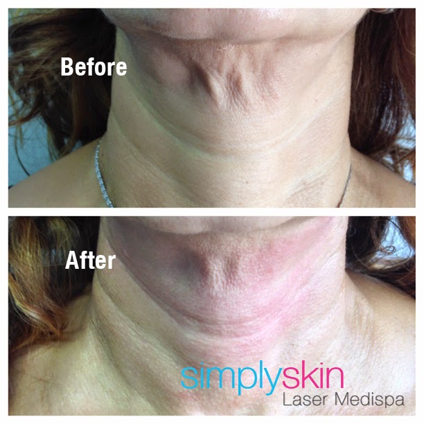 Photo of Simply Skin Laser Medispa in Yonkers City, New York, United States - 10 Picture of Point of interest, Establishment, Health, Spa, Beauty salon, Hair care